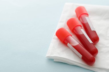 Küresel salgın sırasında Covid-19 virüsünün laboratuvar teşhisi veya koronavirüsü üzerine katlanmış beyaz doku veya kumaş konsepti üzerinde kan örnekleri olan üç test tüpü.
