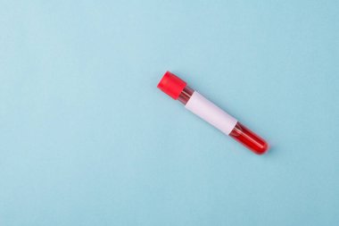 Roman Corornavirus test konsepti. Yukarıda yukarıda, üzerinde kan örneği ve etiket bulunan küçük şişenin mavi renk arkaplanı üzerindeki fotokopi alanı ile yakın görünüm fotoğrafı var.