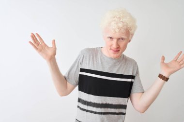 Sıradan tişörtler giyen genç albino bir adam izole edilmiş beyaz arka planda duruyor ve elleri ve kolları havada kafası karışmış bir ifade takınıyor. Şüphe kavramı.