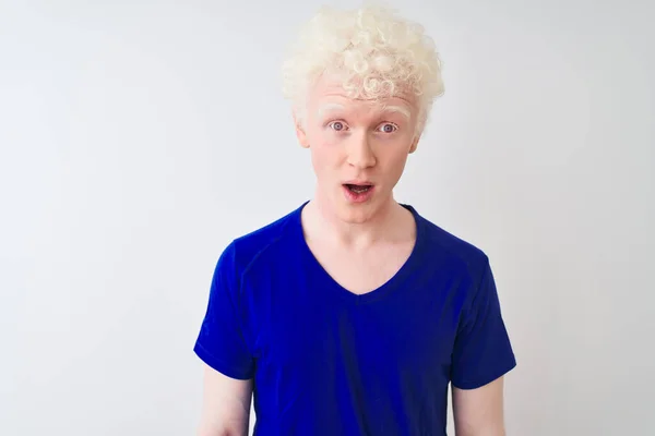 Ung Albino Blond Man Bär Blå Casual Shirt Stående Över — Stockfoto