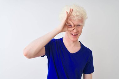 Mavi günlük tişört giyen genç albino adam izole edilmiş beyaz arka planda duruyor. El hareketleriyle gülümsüyor, gözleriyle mutlu yüzlere bakıyor..