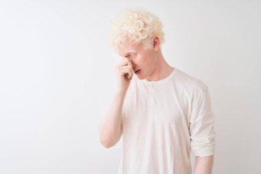 İzole edilmiş beyaz arka plan üzerinde duran gündelik tişört giyen genç albino adam yorgun burnu ve gözleri ovuşturarak yorgunluk ve baş ağrısı hissediyor. Stres ve hüsran kavramı.