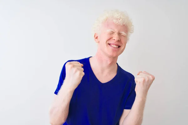 Jeune Homme Blond Albinos Portant Bleu Casual Shirt Debout Sur — Photo