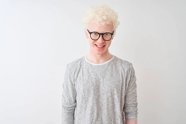 Junger Albino Blonder Mann Mit Gestreiftem Shirt Und Brille Vor — Stockfoto