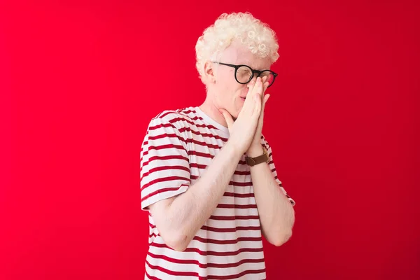 Ung Albino Blond Man Bär Randig Shirt Och Glasögon Över — Stockfoto