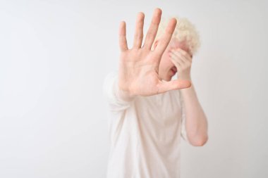 Gündelik tişört giyen genç albino adam izole edilmiş beyaz arka plan üzerinde duruyor gözleri ellerle kaplıyor ve üzgün ve korku ifadeleriyle hareketlerini durduruyor. Utanç verici ve olumsuz bir kavram..