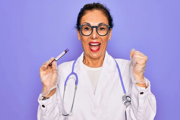 Medico Anziano Mezza Età Che Tiene Medice Campione Sangue Malattia — Foto Stock