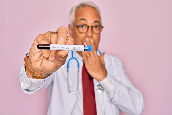 Oberarzt Mittleren Alters Mit Medice Blutprobe Der Coronavirus Infektion Bedecken — Stockfoto