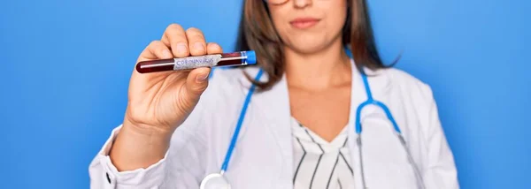Mujer Doctora Joven Sosteniendo Tubo Médico Muestra Sangre Con Enfermedad —  Fotos de Stock