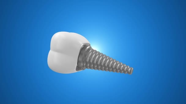 Animatie van tand implantaat op verschillende achtergronden — Stockvideo