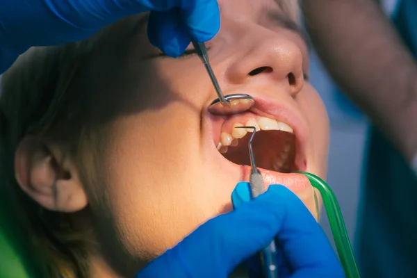 Examen Dentaire Proprement Dit Sur Les Dents Une Femme Dans — Photo