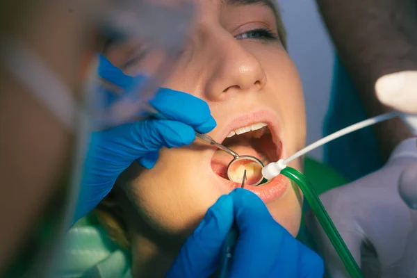 Closeup clean dental examination on a woman\'s teeth in a dental office
