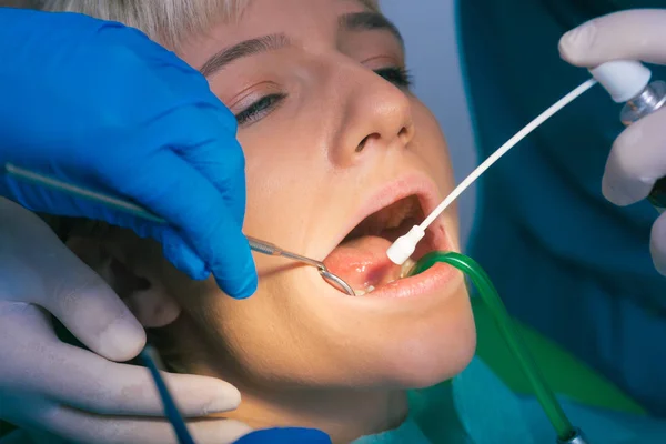 Closeup Καθαρή Οδοντιατρική Εξέταση Στα Δόντια Μιας Γυναίκας Ένα Οδοντιατρικό — Φωτογραφία Αρχείου