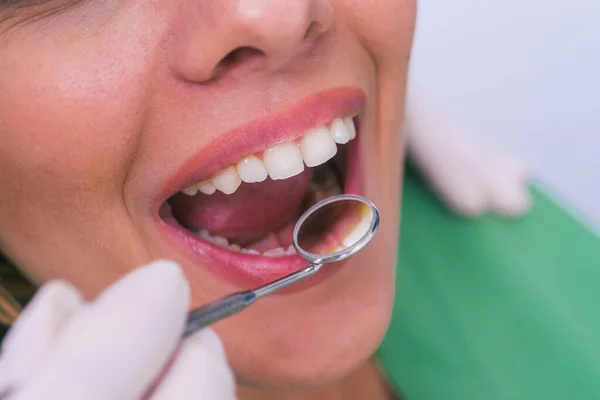 Closeup of a female patient with an open mouth during oral checkup at the dentist.