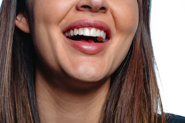 Närbild Ung Kvinna Med Vita Tänder Leende — Stockfoto