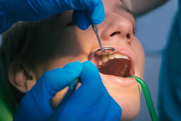 Closeup Exame Dental Limpo Sobre Dentes Uma Mulher Consultório Odontológico — Fotografia de Stock