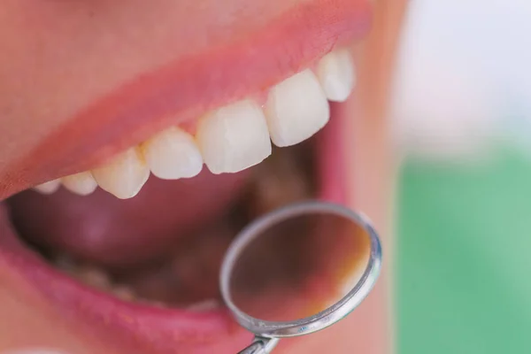 Närbild Kvinnlig Patient Med Öppen Mun Oral Kontroll Hos Tandläkaren — Stockfoto