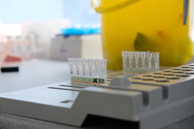 Almaty / Kazakistan - 10.07.2019: Laboratuvar venöz kan kapları