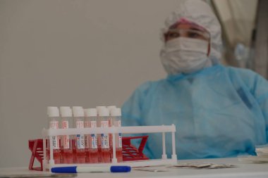 Almaty / Kazakistan - 05.15.2020: Koronavirüs testi için reaktörlü mataralar.