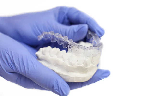 Крупный план индивидуального подноса зубов ортодонтическая стоматологическая тема. В руках невидимые брекеты — стоковое фото