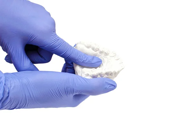 Close-up bandeja de dente individual Tema odontológico ortodôntico. Na mão aparelho invisível — Fotografia de Stock