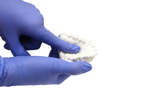 Крупним планом індивідуальний зубний лоток Ортодонтична стоматологічна тема. В руці Невидимі брекети — стокове фото