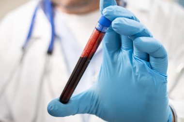 Bir doktorun elinde hayali bir test tüpü kan örneği tutarken görüntüsü, muhtemelen enfekte olmuş..
