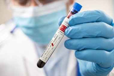 Kurgusal bir test tüpü kan örneği tutan bir doktorun görüntüsü, Coronavirus enfekte.
