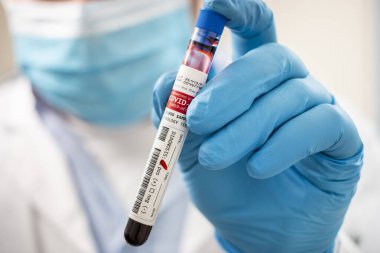 Kurgusal bir test tüpü kan örneği tutan bir doktorun görüntüsü, Coronavirus enfekte.