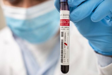 Kurgusal bir test tüpü kan örneği tutan bir doktorun görüntüsü, Coronavirus enfekte.