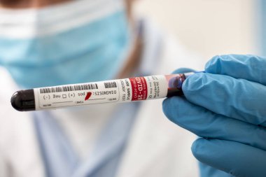 Kurgusal bir test tüpü kan örneği tutan bir doktorun görüntüsü, Coronavirus enfekte.