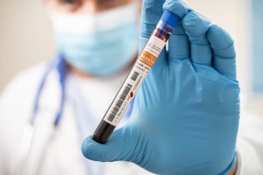 Kızamık virüsü bulaşmış kurgusal bir test tüpü kan örneğini elinde tutan bir doktorun görüntüsü..