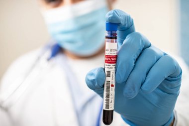 HlV / AIDS virüsü taşıyan hayali bir test tüpü kan örneğini elinde tutan bir doktorun görüntüsü.