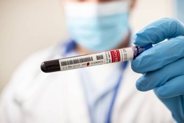 HlV / AIDS virüsü taşıyan hayali bir test tüpü kan örneğini elinde tutan bir doktorun görüntüsü.
