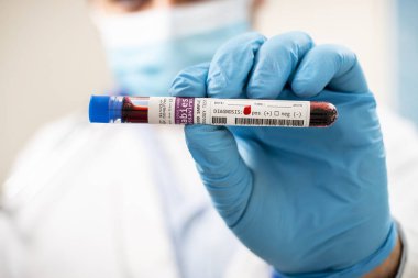 Kuduz virüsü bulaşmış kurgusal bir test tüpü kan örneğini elinde tutan bir doktorun görüntüsü..