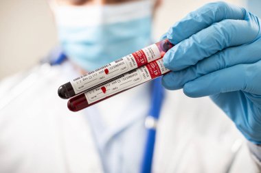 Kurgusal bir test tüpü tutan bir doktorun görüntüsü. Kan örnekleri, koronavirüs enfeksiyonu..