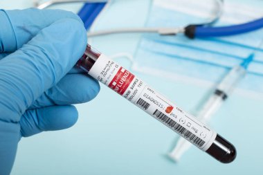 Açık mavi arka planda steteskop, maske ve şırınga ile enfekte olmuş Influenza virüslü hayali kan örnekleri.