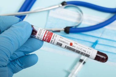 Açık mavi arka planda steteskop, maske ve şırınga ile enfekte olmuş Hepatit E virüsü içeren hayali kan örnekleri..