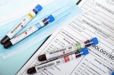 Laboratuvar raporu ve koruyucu maskesi olan çeşitli virüslü kurgusal kan örnekleri..