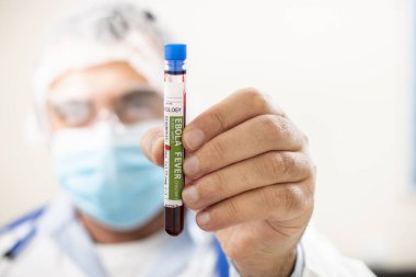 Elinde hayali bir test tüpü olan ebola virüsü bulaşmış bir doktorun görüntüsü..