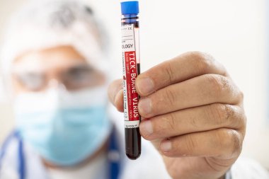 Elinde hayali bir test tüpü kan örneği tutan bir doktorun görüntüsü kene kaynaklı virüsle enfekte olmuş..