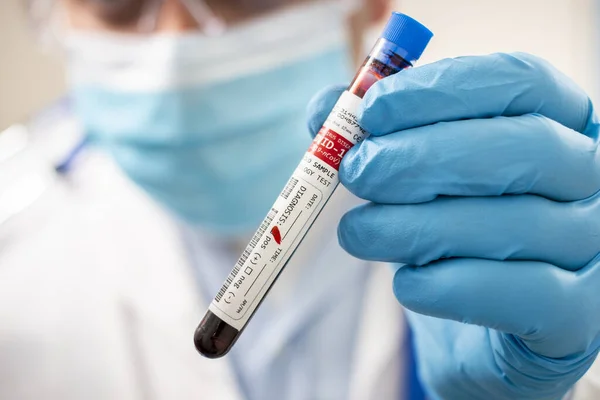 一个医生拿着一个虚构的试管血样 感染了考拉韦的照片 — 图库照片