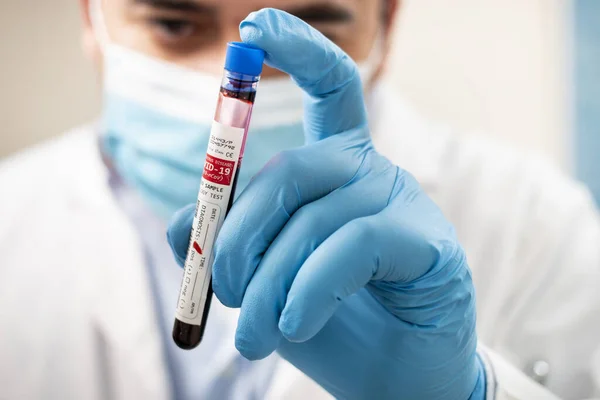 一个医生拿着一个虚构的试管血样 感染了考拉韦的照片 — 图库照片