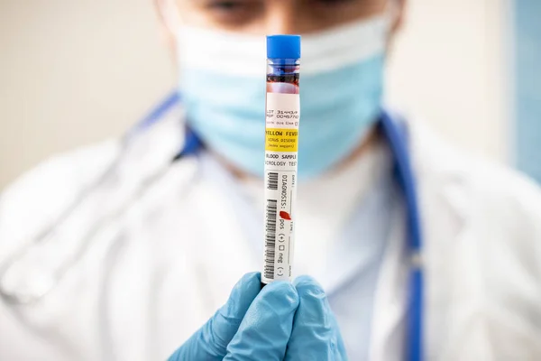 医生携带一个虚构的试管血样 感染黄热病病毒 — 图库照片