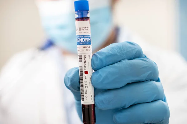 一个医生拿着一个虚构的试管血样 感染了亨德雷病毒 — 图库照片
