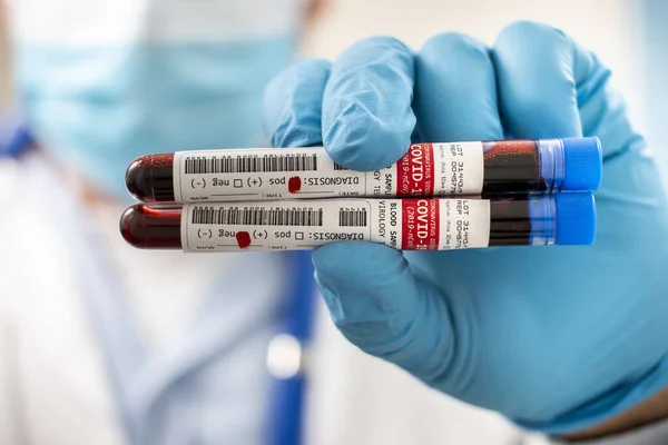 Vista Médico Sosteniendo Una Muestra Sangre Tubos Ensayo Ficticios Infectado —  Fotos de Stock