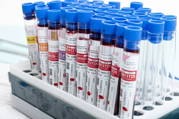 几个虚构的带有各种病毒的感染血液样本放在一个小瓶架上 — 图库照片