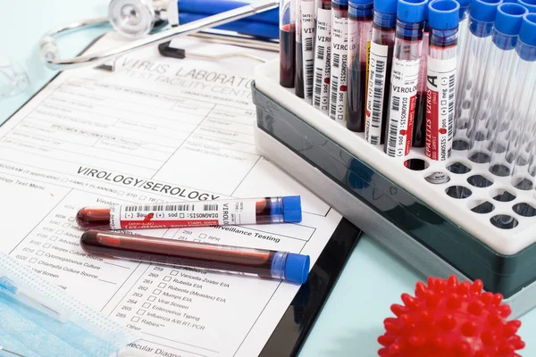 一些带有各种病毒的虚构感染血液样本 附有实验室报告 面罩和注射器 — 图库照片