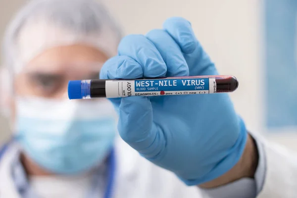 Batı Nil virüsü bulaşmış kurgusal bir test tüpü kan örneğini elinde tutan bir doktorun görüntüsü..