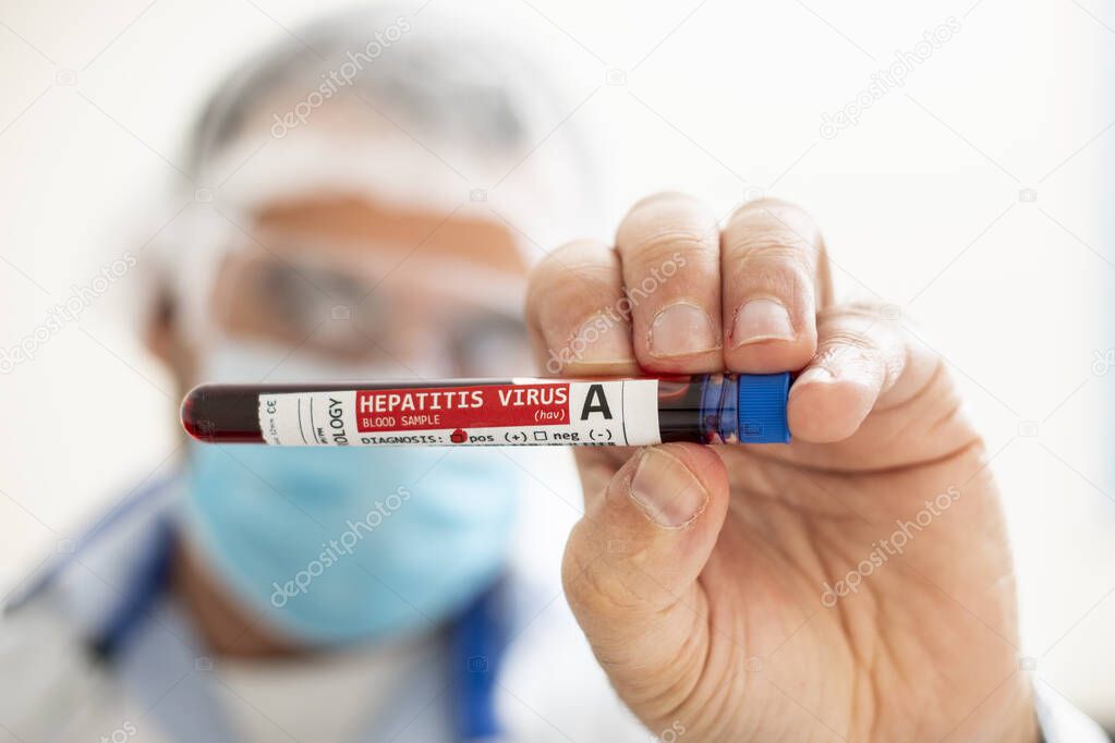 View of a doctor holding a fictional test tube blood sample, infected with Hepatitis A virus.